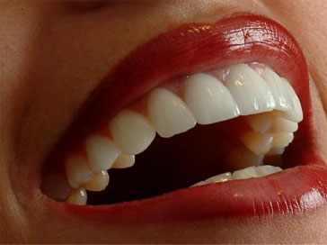 cosmetic-dentisty_1