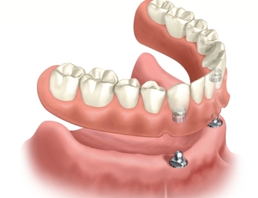 dental-2
