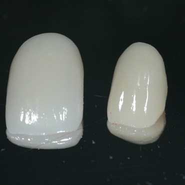 The all ceramic crowns